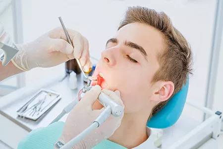 Dental Fillings